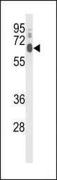 Anti-LPCAT1 antibody, C-term used in Western Blot (WB). GTX80419