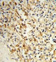 Anti-LPCAT1 antibody, C-term used in IHC (Paraffin sections) (IHC-P). GTX80419