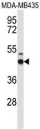 Anti-GABA A Receptor delta antibody, Internal used in Western Blot (WB). GTX80429