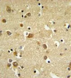 Anti-GABA A Receptor delta antibody, Internal used in IHC (Paraffin sections) (IHC-P). GTX80429