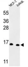 Anti-SNRPD3 antibody, C-term used in Western Blot (WB). GTX80441