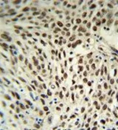 Anti-SNRPD3 antibody, C-term used in IHC (Paraffin sections) (IHC-P). GTX80441