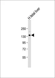 Anti-Xanthine Oxidase antibody, N-term used in Western Blot (WB). GTX80444
