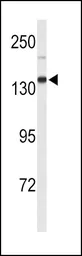 Anti-Xanthine Oxidase antibody, N-term used in Western Blot (WB). GTX80444