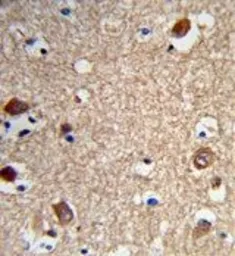 Anti-ACTR5 antibody, C-term used in IHC (Paraffin sections) (IHC-P). GTX80453