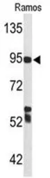 Anti-C7 antibody, Internal used in Western Blot (WB). GTX80456