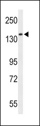Anti-RECK antibody, Internal used in Western Blot (WB). GTX80458