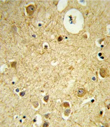 Anti-RECK antibody, Internal used in IHC (Paraffin sections) (IHC-P). GTX80458