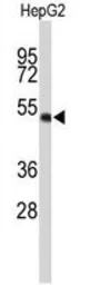 Anti-WDR37 antibody, C-term used in Western Blot (WB). GTX80465