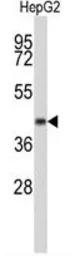 Anti-ERGIC3 antibody, N-term used in Western Blot (WB). GTX80486