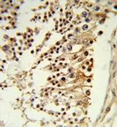 Anti-CENPH antibody, Internal used in IHC (Paraffin sections) (IHC-P). GTX80491