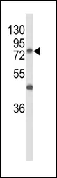 Anti-GALNT3 antibody, Internal used in Western Blot (WB). GTX80494