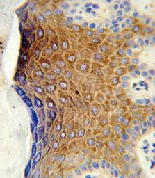 Anti-GALNT3 antibody, Internal used in IHC (Paraffin sections) (IHC-P). GTX80494
