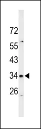 Anti-ZIP3 antibody, Internal used in Western Blot (WB). GTX80495