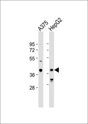 Anti-DHRS3 antibody, Internal used in Western Blot (WB). GTX80507