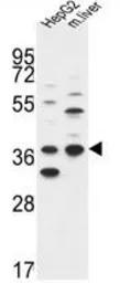 Anti-DHRS3 antibody, Internal used in Western Blot (WB). GTX80507