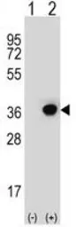 Anti-DHRS3 antibody, Internal used in Western Blot (WB). GTX80507