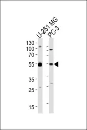Anti-DEK antibody, C-term used in Western Blot (WB). GTX80509
