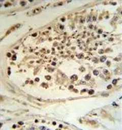 Anti-DEK antibody, C-term used in IHC (Paraffin sections) (IHC-P). GTX80509