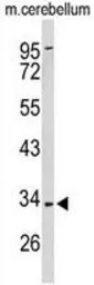 Anti-Peroxin 2 antibody, Internal used in Western Blot (WB). GTX80512
