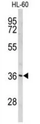 Anti-PEX14 antibody, C-term used in Western Blot (WB). GTX80530