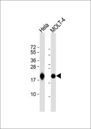 Anti-RPL18A antibody, C-term used in Western Blot (WB). GTX80536