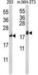 Anti-RPL18A antibody, C-term used in Western Blot (WB). GTX80536