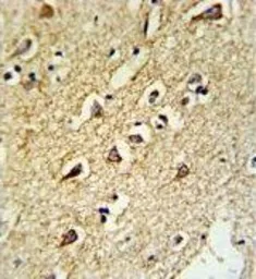 Anti-RPL18A antibody, C-term used in IHC (Paraffin sections) (IHC-P). GTX80536