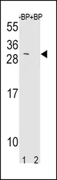 Anti-TIMP3 antibody, Internal used in Western Blot (WB). GTX80547