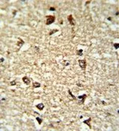 Anti-CDC2L6 antibody, Internal used in IHC (Paraffin sections) (IHC-P). GTX80572