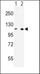 Anti-MTTP antibody, C-term used in Western Blot (WB). GTX80580