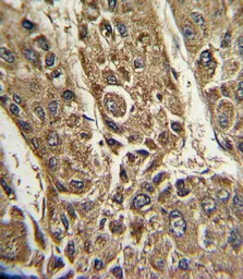 Anti-MTTP antibody, C-term used in IHC (Paraffin sections) (IHC-P). GTX80580
