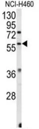 Anti-ERR beta antibody, Internal used in Western Blot (WB). GTX80586