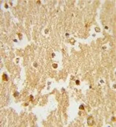 Anti-ERR beta antibody, Internal used in IHC (Paraffin sections) (IHC-P). GTX80586
