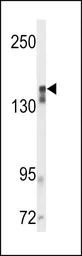 Anti-VEGF Receptor 2 antibody used in Western Blot (WB). GTX80591