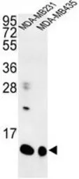 Anti-SPRR1B antibody, C-term used in Western Blot (WB). GTX80592