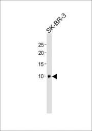 Anti-SPRR1B antibody, C-term used in Western Blot (WB). GTX80592