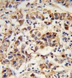 Anti-SPRR1B antibody, C-term used in IHC (Paraffin sections) (IHC-P). GTX80592