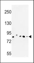 Anti-CHSY2 antibody, Internal used in Western Blot (WB). GTX80597