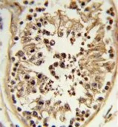 Anti-CHSY2 antibody, Internal used in IHC (Paraffin sections) (IHC-P). GTX80597