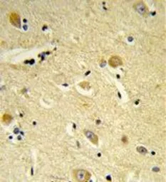 Anti-CDIPT antibody, Internal used in IHC (Paraffin sections) (IHC-P). GTX80599