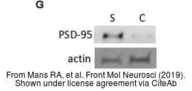 Anti-PSD95 antibody [7E3-1B8] used in Western Blot (WB). GTX80682