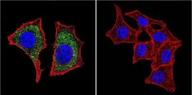 Anti-beta Catenin antibody [9F2] used in Immunocytochemistry/ Immunofluorescence (ICC/IF). GTX80686