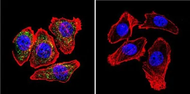 Anti-beta Catenin antibody [9F2] used in Immunocytochemistry/ Immunofluorescence (ICC/IF). GTX80686