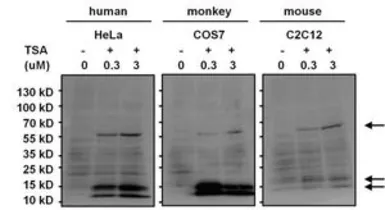 Anti-Acetyl Lysine antibody [1C6] used in Western Blot (WB). GTX80693