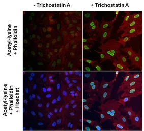 Anti-Acetyl Lysine antibody [1C6] used in Immunocytochemistry/ Immunofluorescence (ICC/IF). GTX80693