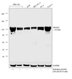 Anti-KAP1 antibody [20C1] used in Western Blot (WB). GTX80695