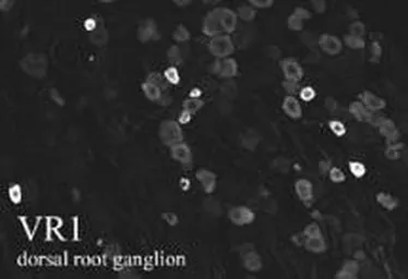 Anti-VR1/ TRPV1 antibody used in IHC (Frozen sections) (IHC-Fr). GTX80798