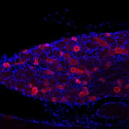 Anti-VR1/ TRPV1 antibody used in Immunohistochemistry (IHC). GTX80798
