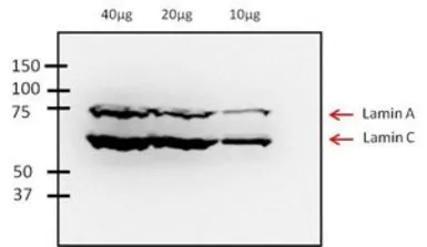 Anti-Lamin A + C antibody [mab636] used in Western Blot (WB). GTX80813